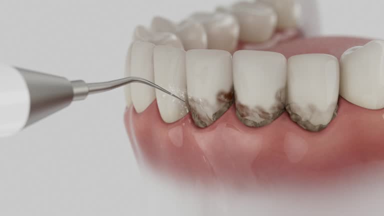 Trusted Teeth Cleaning And Checkup service in Largo, FL - Dentist Open Now